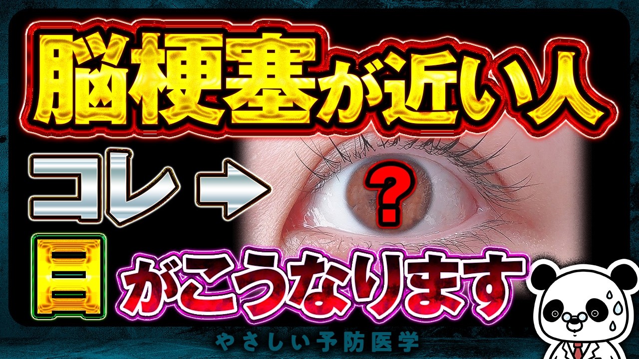 【要注意】絶対知っておいてほしい！脳梗塞が近い人だけに起こる「目の異変」について解説（脳梗塞　危険なサイン）