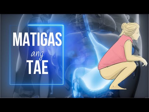 Video: Paano Mapagaling ang isang Hematoma sa Bahay (may Mga Larawan)