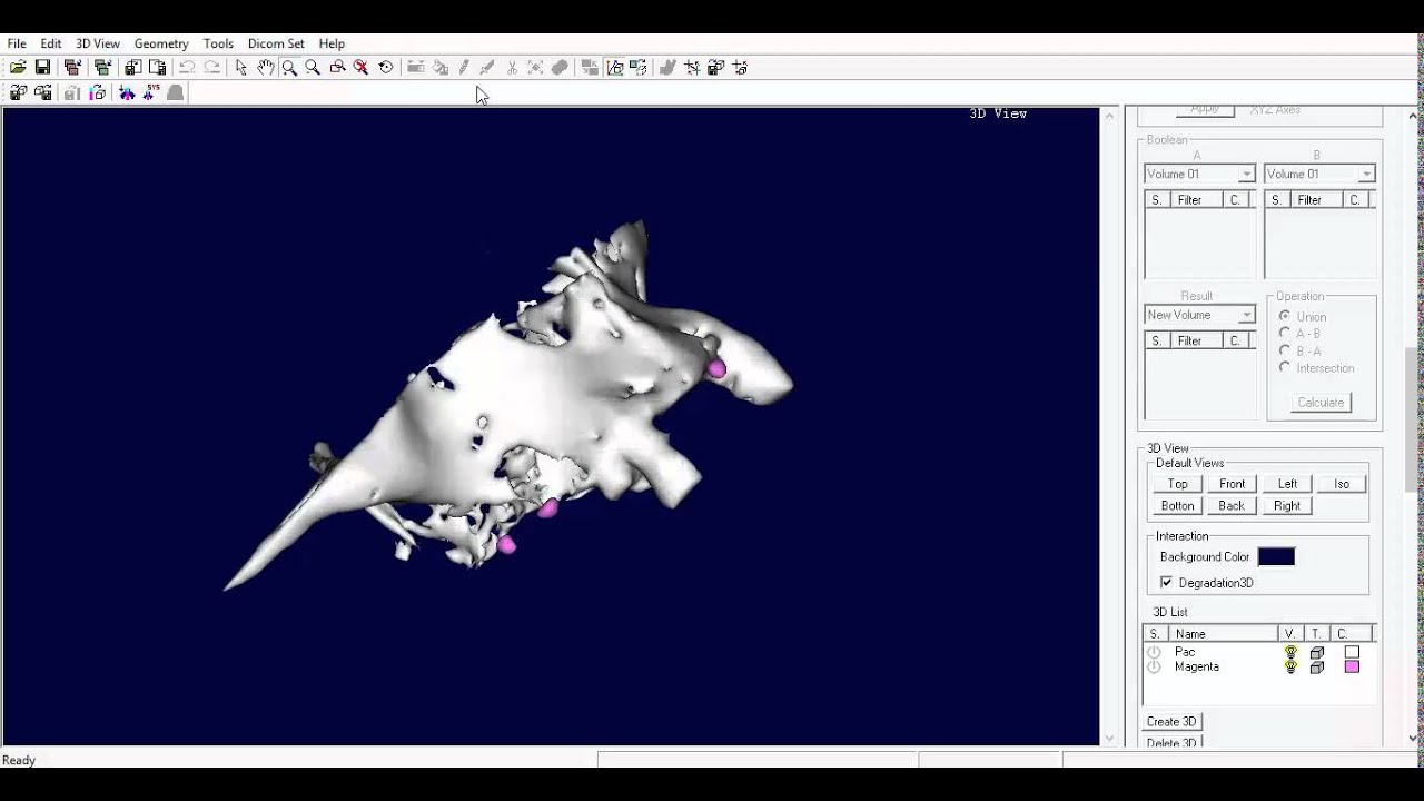 Tutorial de Alinhamento Com Prótese Conversor DentalSlice