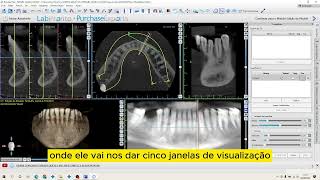 Vídeo Tutorial de Planejamento de Implante Dentário no Software Blue Sky Plan - INICIAL screenshot 5