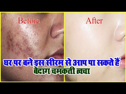 घर पर बने इस सीरम से आप पा सकते हैं बेदाग चमकती त्वचा
