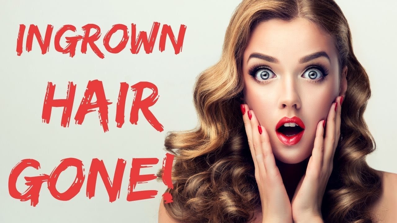 Ingrown Hair Gone Using Beelicious Buff Stuff Youtube