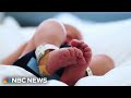 Bipartisan push aims to make childbirth free amid rising costs