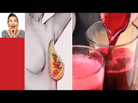 Vidéo: Comment Boire Du Jus De Betterave ?