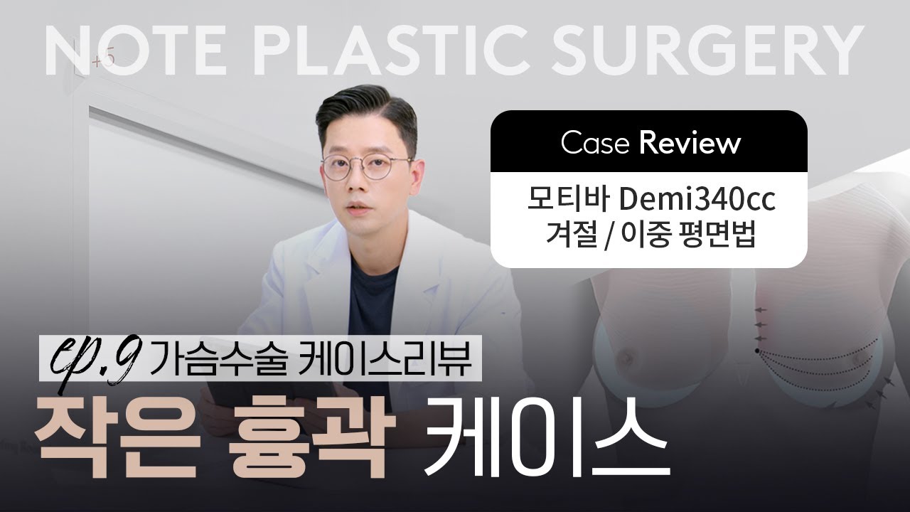[가슴리뷰] 타이트한 살성 l 작은 흉곽 케이스 l 모티바