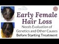 Treating Difficult Female Pattern Hair Loss Successfully in Over 99% of Patients