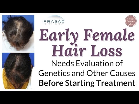 Treating Difficult Female Pattern Hair Loss Successfully in Over 99% of Patients