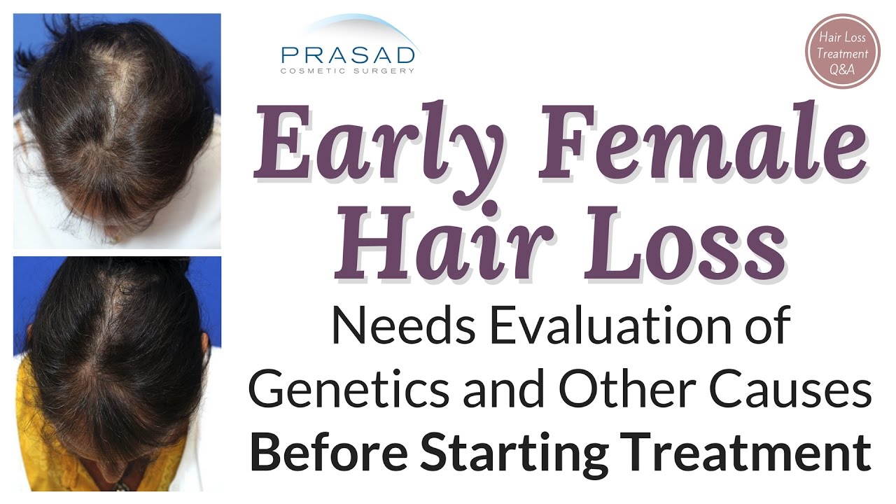 How to treat genetic hair loss or androgenic alopecia  Traya