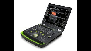 Professional 3D 4D ultrasound scan doppler ultrasound MSLCU56 video operation Professional 3D 4D ultrasound scan doppler ultrasound MSLCU56 video operation