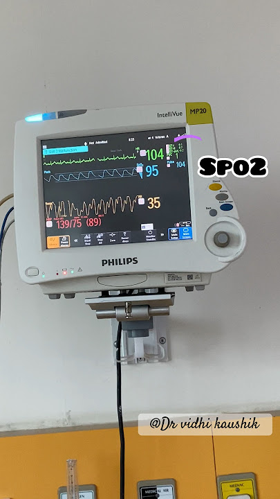 Icu screen monitoring vitals #icu #ventilator #medical #shortfeed #ytshorts #drvidhikaushik