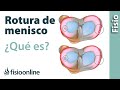 Rotura de menisco y meniscitis - ¿Qué es?