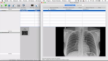 How to install OsiriX plugins
