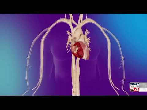 30/01/24 - Cardiologia Cirie', fra le prime ad impiantare un pacemaker senza fili