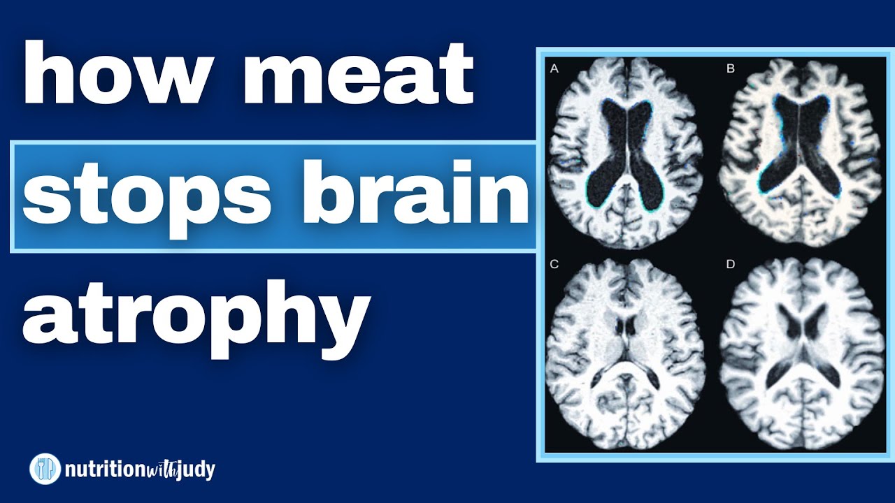 Why Vegans Have Smaller Brains: What the Science Shares - YouTube
