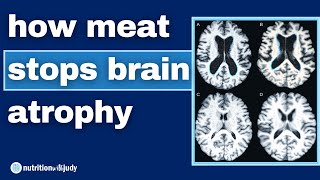 Why Vegans Have Smaller Brains: What the Science Shares