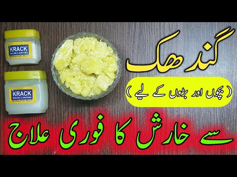 Gandak Say Kharish Ka Ilaj Kary Kharish Ka Fori Ilaj Gandak Ka Istamal Bachon Ki Kharish Ka Ilaj