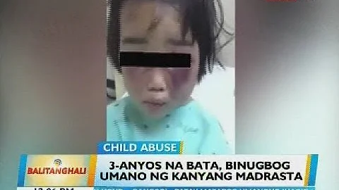 3-anyos na bata, binugbog umano ng kanyang madrasta