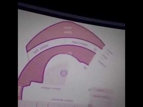 Pink Trombone Oh Yeah Meme 