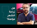 هل زراعة الشعر مؤلمة 