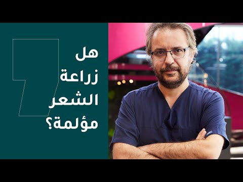 هل زراعة الشعر مؤلمة