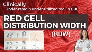 Red cell Distribution Width (RDW) - What is it and what are its uses