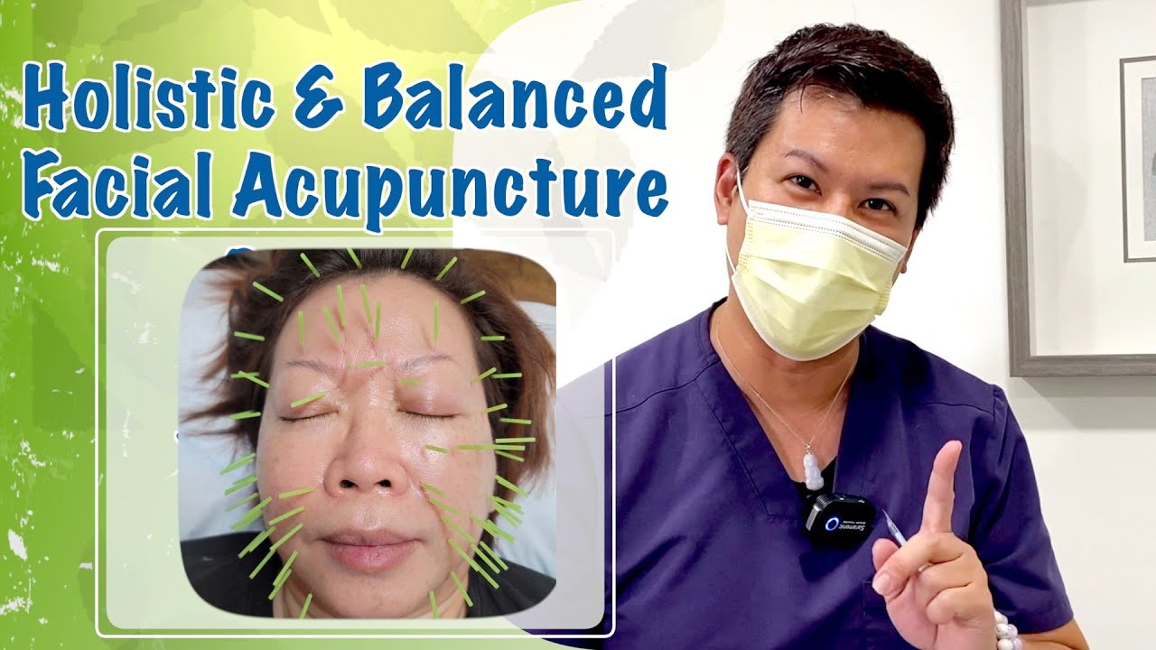 Facial acupuncture starting from legs, WHY? YouTube