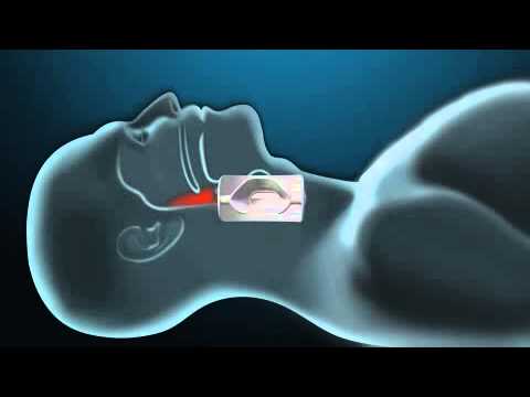 Эффективное средство от ХРАПА!!!100% результат Антихрап new! www antihrap by