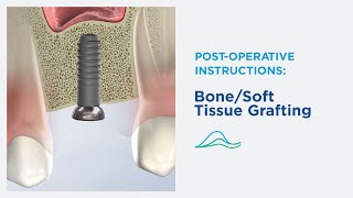 Post-Operative Instructions: Bone Grafting in Dexter, MA