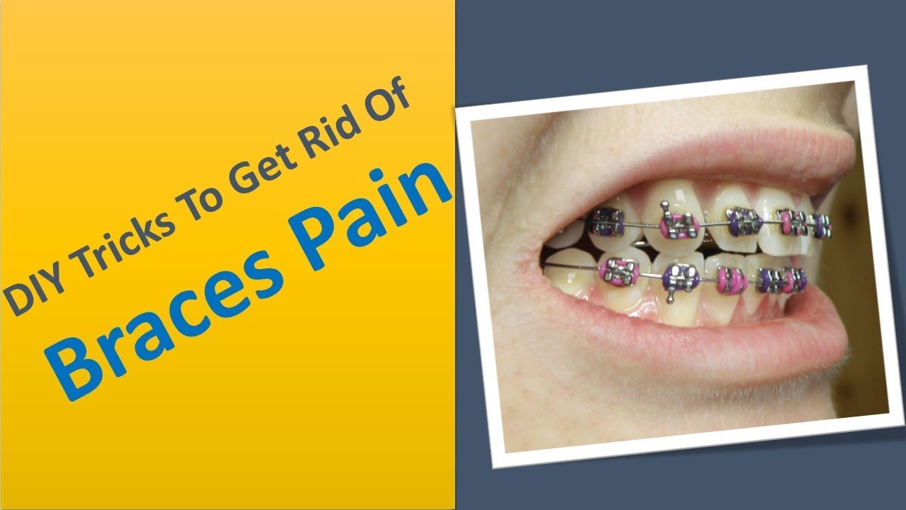 How To Cure Braces Pain Orthodontics Maloccclusion Other Problems And