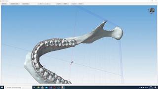 Orthodontic brace profiliser (tooth wire profiliser-prework) screenshot 4