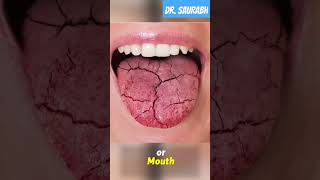 Symptoms of  Vitamin A  deficiancy you must know  youtubeshorts mbbs ytool shortvideo doctor