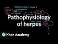 Pathophysiology of herpes | Infectious diseases | NCLEX-RN | Khan Academy