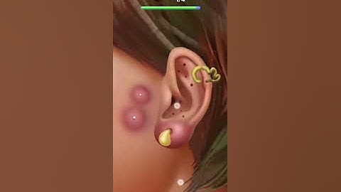 Screw Match (level 35-40) ASMR