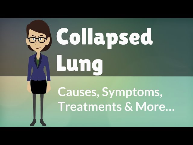 Collapsed Lung -  Causes, Symptoms, Treatments & More… class=