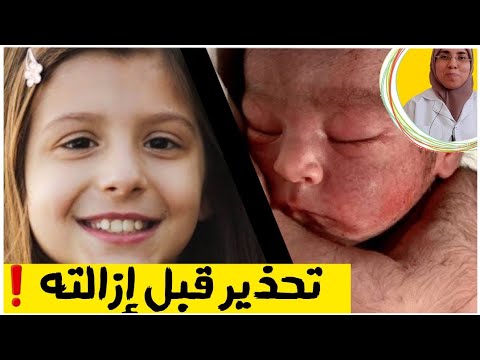 فيديو: حلو وسلس! قالت آنا خلكيفيتش إنها قامت بعملية إزالة الشعر