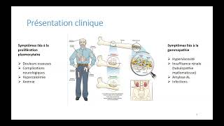 Myélome Mulitiple par le Dr Julien HENRY du service Immuno-rhumatologie de l'Hopital Bicetre AP-HP
