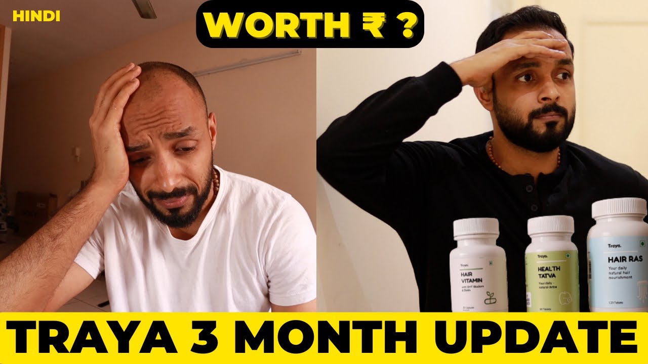 ✅ Traya Hair Regrowth👩‍🦲3 Month Progress Update 👉 My Honest Opinion 🟡 from hair loss to Thicker Hair