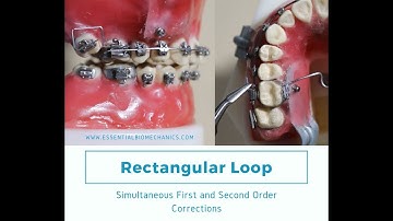 Rectangular_Loop_GIV_Activation