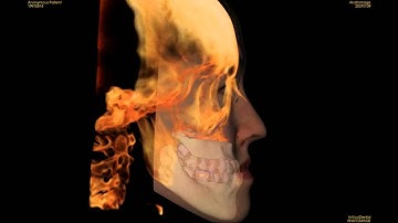 3D Soft Tissue Simulation with Invivo5 1