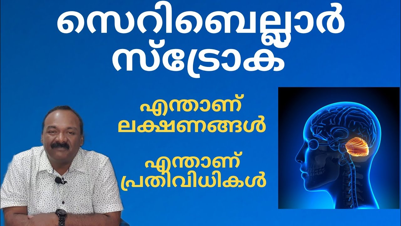 ബാലൻസ് നഷ്ടപ്പെടുന്നു |ചലനങ്ങളുടെ കൃത്യത നഷ്ടപ്പെടുന്നു |cerebellar stroke