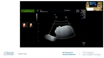 GE Voluson E10 3D Imaging Training Video Demonstration