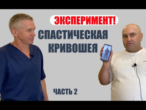 Спастическая кривошея. Часть