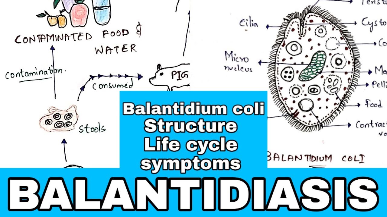 Az amoebiasis giardiasis balantidiasis protozoális bélfertőzés okozói - idealbutor-szeged.hu