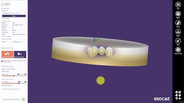 Multi-layer Blanks (exocam 2016)