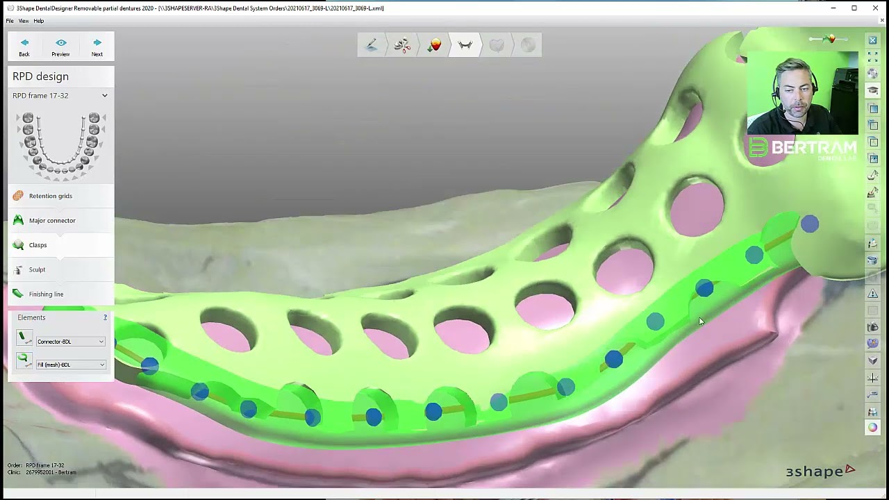 3Shape Cad training how to create resin gap over .90mm for your RPD-#7