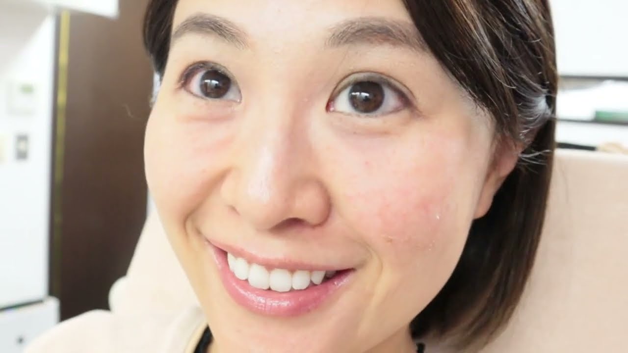 目元のエイジングケア 美容整形の 共立美容外科