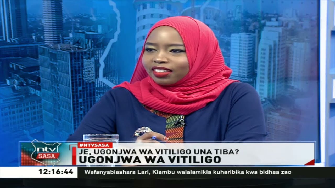 Je, ugonjwa wa vitiligo una tiba? | NTV Sasa