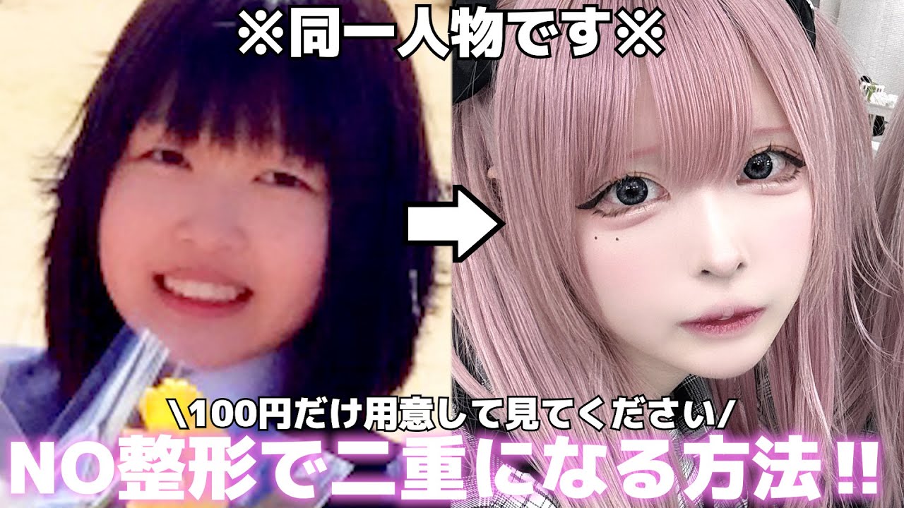 17年間一重だったワイがたった100円(ガチ)で二重にした方法教える‼整形外科の先生もダマした癖付け法がえぐすぎるので爆拡散キボンヌ