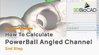 How To Calculate PowerBall Angled Channel 2nd Step l FOLLOW-ME! hyperDENT l 3DBioCAD