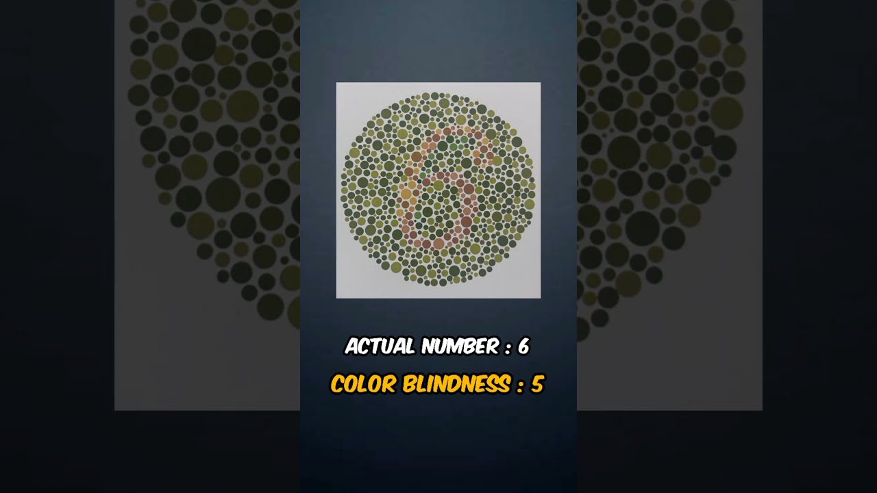 Colour vision test | Tamil | Dr. Syed Moosa | Eye Doctor |